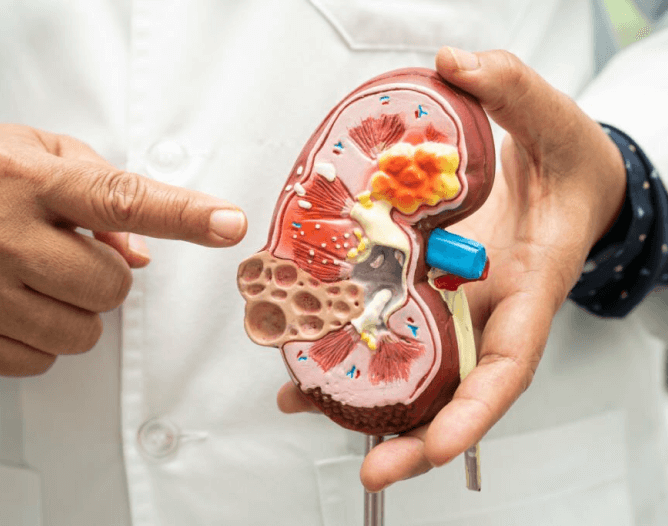 Nephrology medical Billing Services